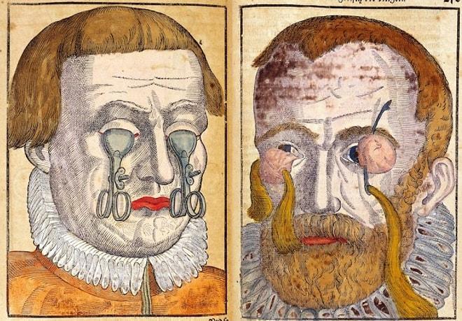 Kafatasını, Beyni ve Diğer Organları Konu Almış, 1700'lü Yıllardan 17 Rahatsız Edici Resim
