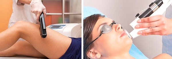 2. Ты перепробовала все: бритву, эпилятор, воск, лазерное удаление волос