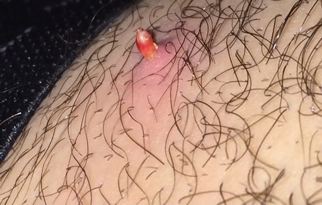 6. 🙈