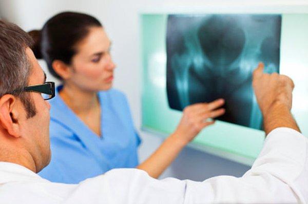 2. Radyoloji teknikerliği,hastanede doktorlar ile en çok karıştırılan meslek grubudur.
