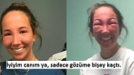 Filmdi Gerçek Oldu! Gözüne Zehirli Sarmaşık Değen Kız Sosyal Medyayı Kırdı Geçirdi