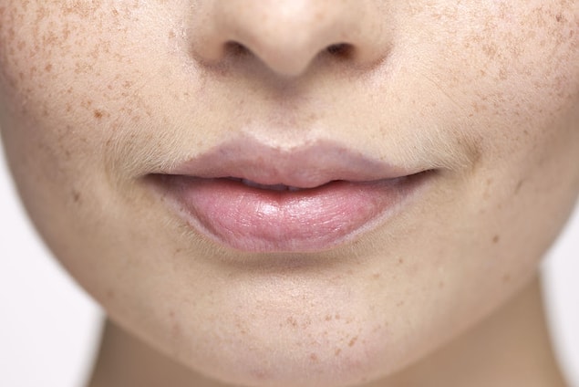 18. Not moisturizing your lips enough.
