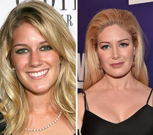 7. Heidi Montag