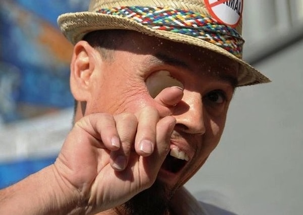 11. Это Билли Оуэн, и он действительно может высунуть палец из глазницы через рот. Из-за редкой формы рака Билли потерял пол-лица и правый глаз. Билли достаточно вытащить протез-пластинку, чтобы просунуть в глазницу палец. Сейчас Билли зарабатывает на жизнь тем, что играет зомби в различных фестивалях и шоу.