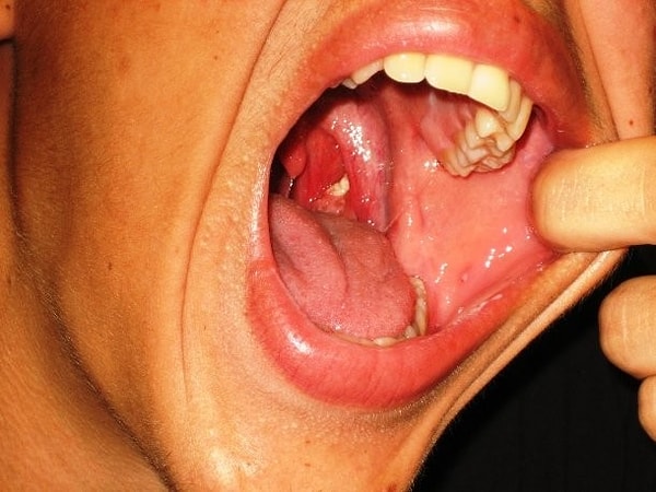 7. Оценщик запаха изо рта