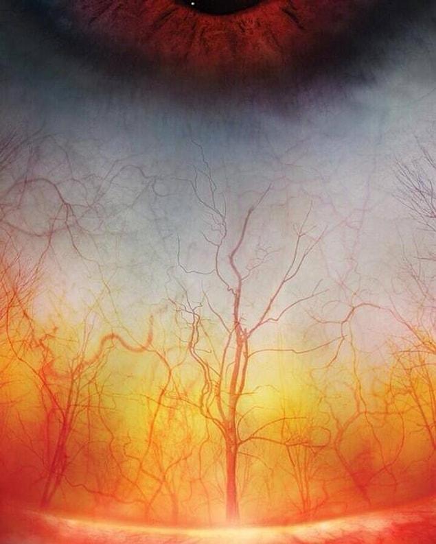 1. The human eye looks like a burning forest