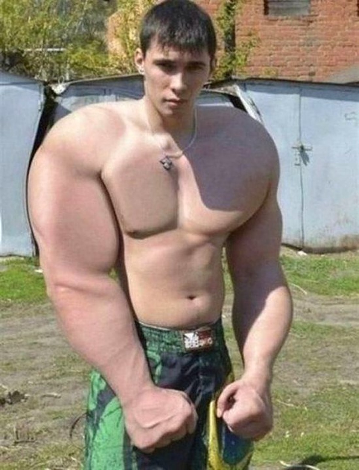 Synthol Fail