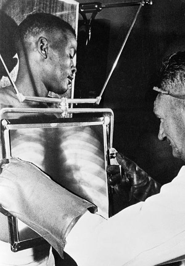 4. De Beer maden işçileri elmas madeninden ayrılmadan önce her vardiya sonunda X-ray ile kontrol ediliyor, Güney Afrika, 1954.