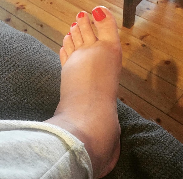 6. Не носить модные туфли из-за того, что опухли ноги