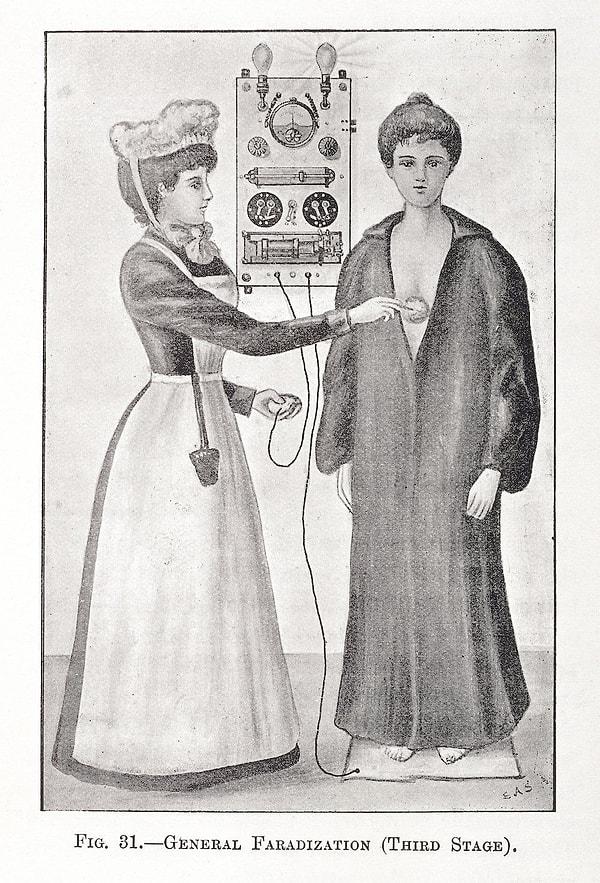 Elektrikli kas uyarımının 3. evresi. Hemşire, bir kadın hastaya vibratör yardımıyla elektrik akımı uyguluyor. (1900)