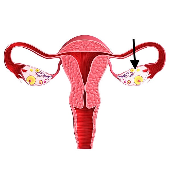 9. Как называются эти желтые сферы разных размеров?