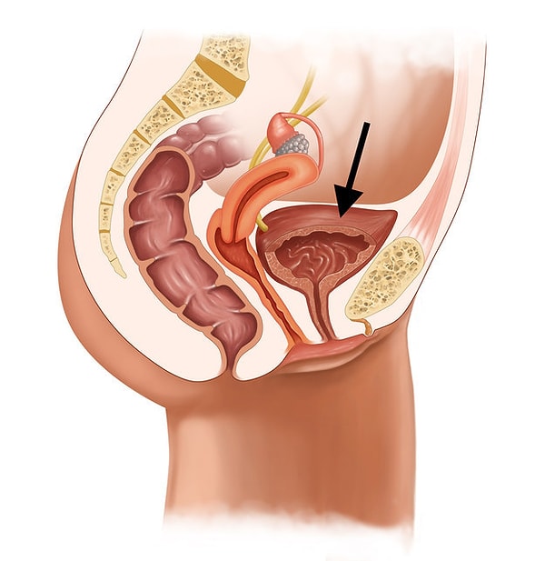 10. Видишь эту полость темно-красного цвета? Что это может быть?