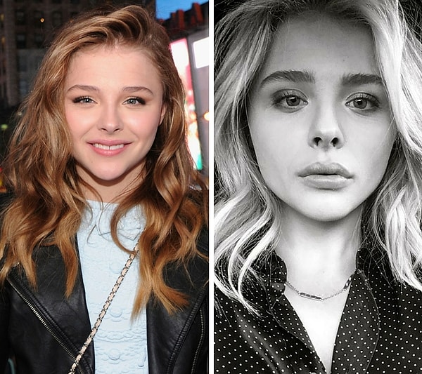 Chloë Grace Moretz Plastic Surgery Speculation Nose Job & Lip Fillers