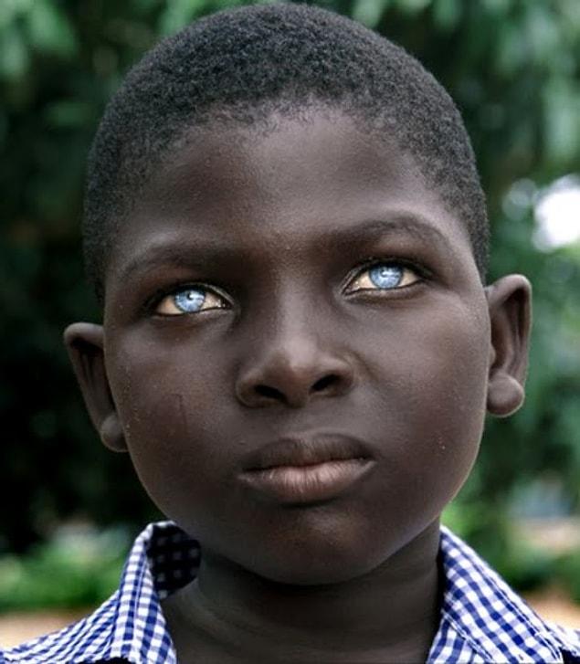 3. A young African boy with blue eyes