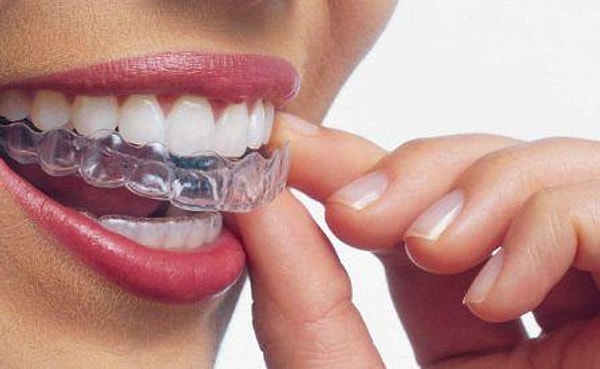 8. Заниматься с ним сексом, не снимая трейнер или пластинку для выравнивания зубов