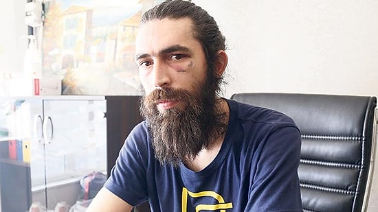 Ankara'da Darp Edilen Genç Konuştu: 'Cinayete Kurban Gideceğimi Düşündüm'