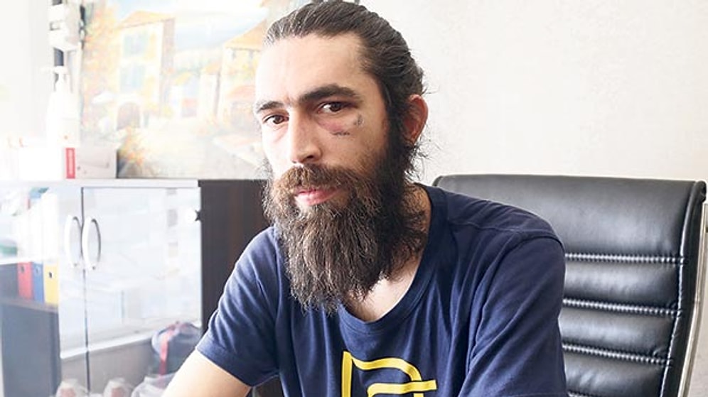 Ankara'da Darp Edilen Genç Konuştu: 'Cinayete Kurban Gideceğimi Düşündüm'