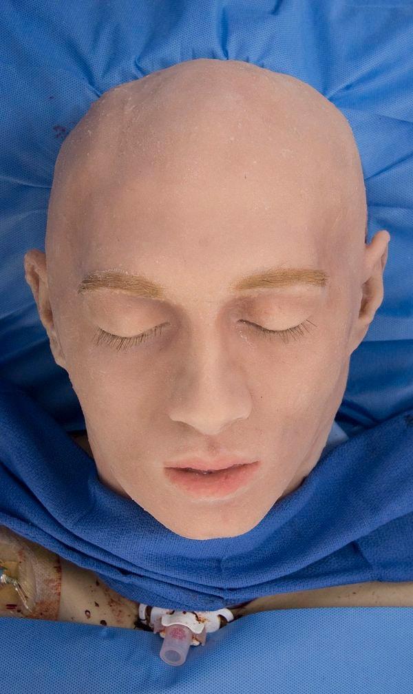 Kafa derisi ayrılan donörün yüzü, daha sonra silikon bir maskeyle kapatılır.