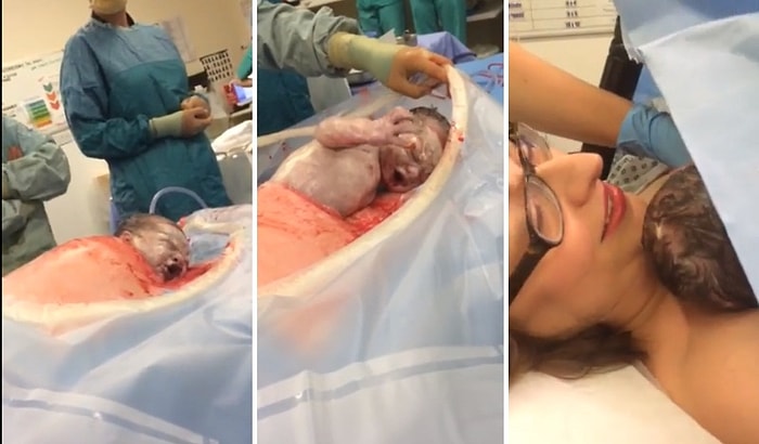 Doktorların Hiçbir Müdahalesine Gerek Kalmadan Annesinin Karnından Kendi Çıkan Bebek