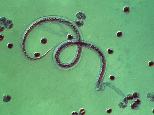3 kinds of parasitic worms lead to this disease.
