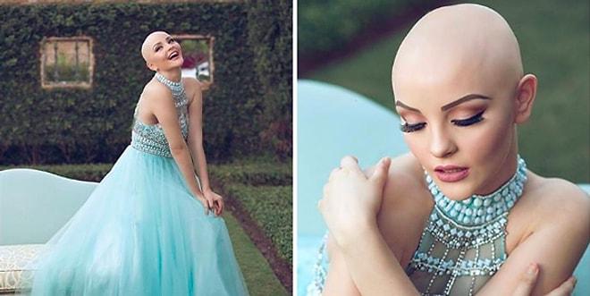 Kanser Yüzünden Saçlarını Kaybeden Genç Modelden İnsanlara Harika Mesajlar