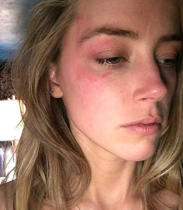 3. Оказалось, что Эмбер хочет развестись с Деппом из-за насилия в доме!