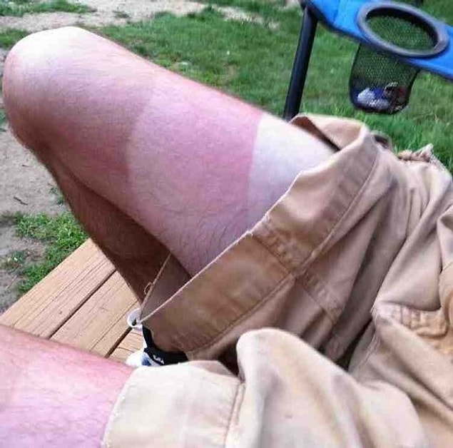 7. You could’ve ended up like a monochrome rainbow when you were trying to even out your tan.