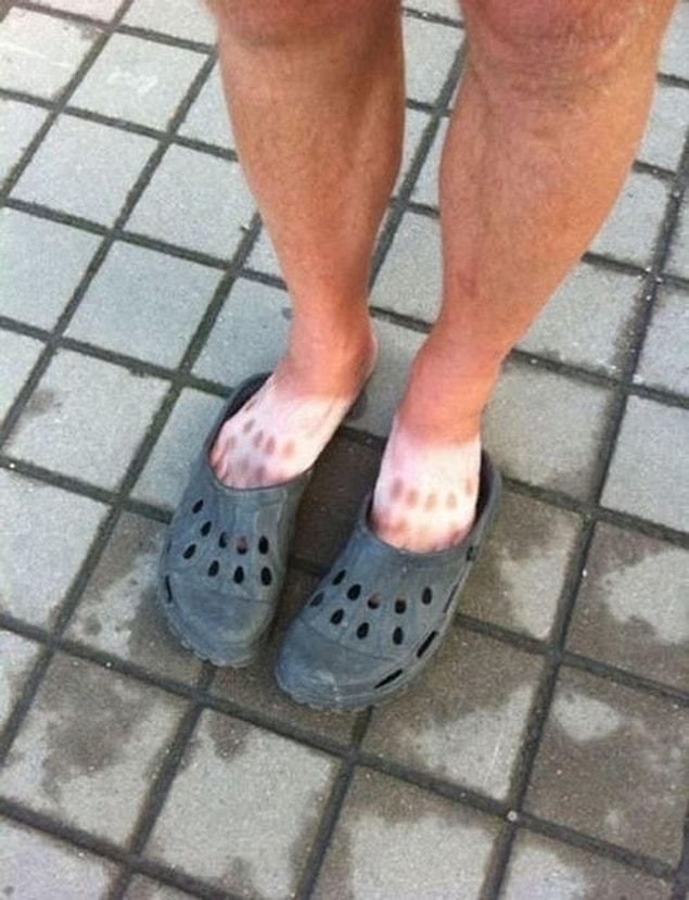 17. What if you had to wear your damn Crocs until the end of summer?