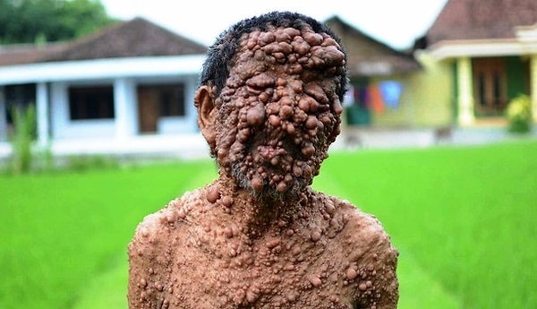 17. Вот такое заболевание