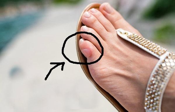 7. Отрывает пальцами сухие мозоли