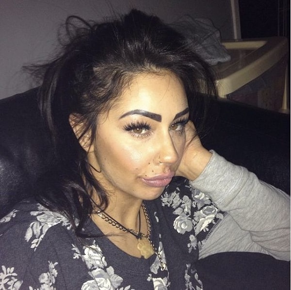 1. Как будут выглядеть губы, если доза для них составляет 6,5 мл?