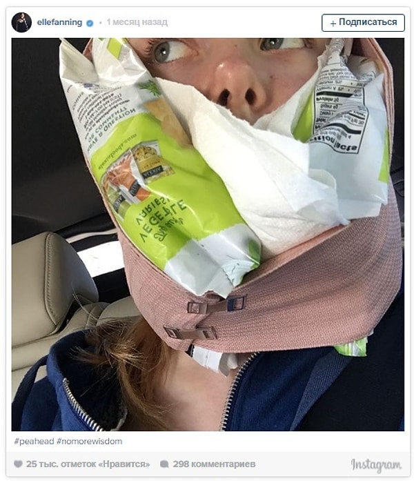 10. Эль Фаннинг, после того, как ей вырвали зуб мудрости