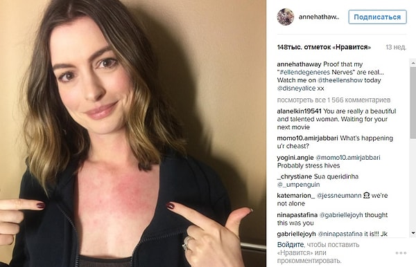 14. Энн Хэтэуэй и ее нервная сыпь