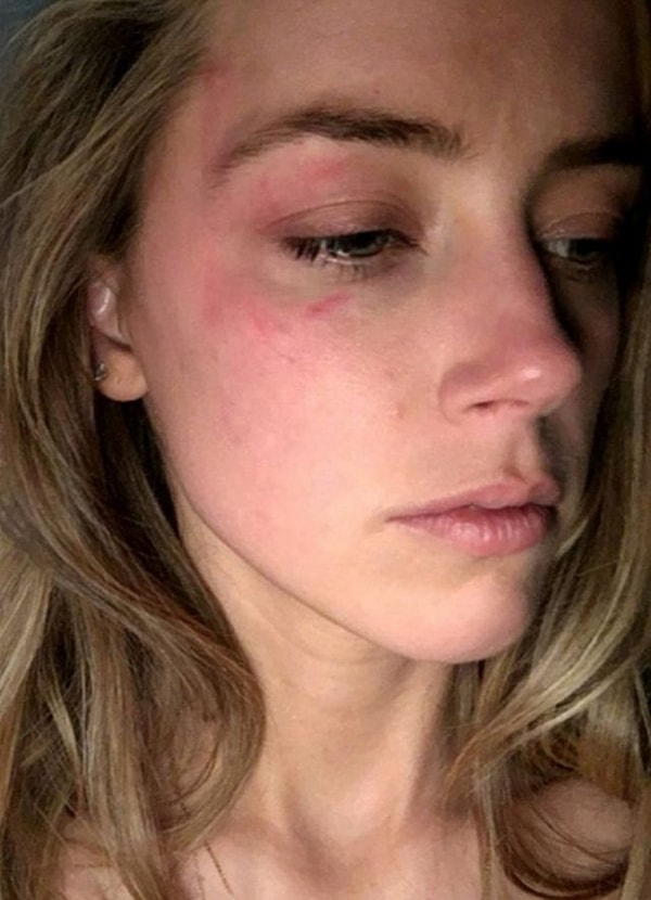 5. Эмбер Хёрд