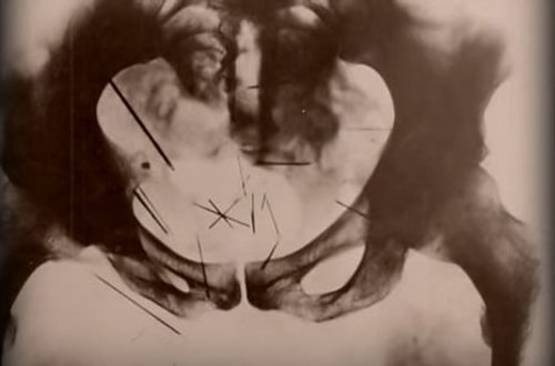 Albert Fish: In Sin He Found Salvation (2007)