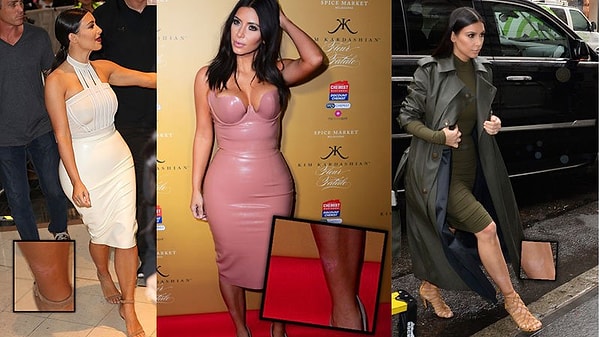 Но, как выяснилось, многие из них просто стараются скрывать свои болезни и не говорить о них публично.