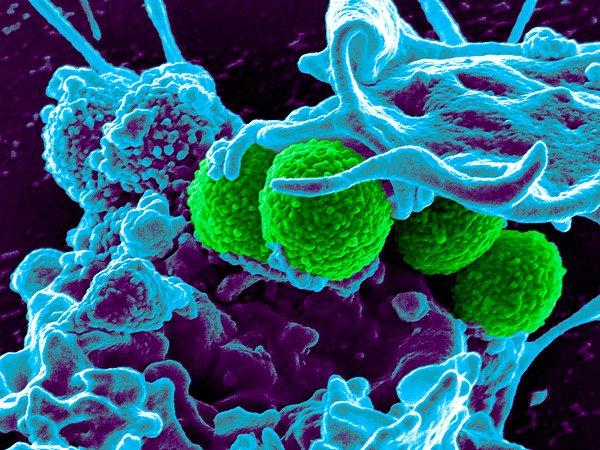 13. Bilim insanları geçtiğimiz yıl, yeni bir antibiyotik türü olan Teixobactin'in keşfini duyurdu.
