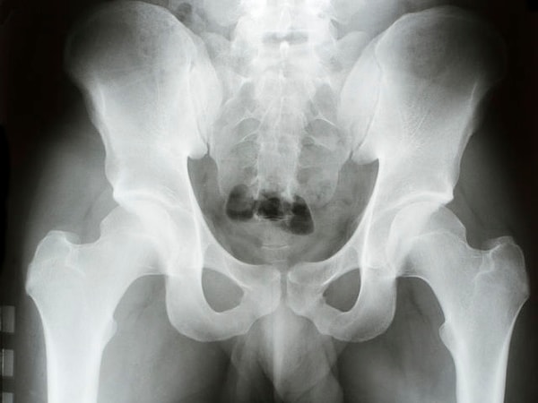 Твой наиболее думающий орган находится ниже пояса