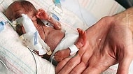 Gerçek Parmak Kız! Sadece 226 Gram Ağırlığında Doğan Dünyanın En Küçük Bebeği Emilia