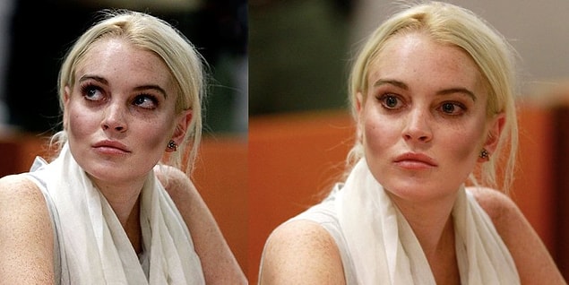 7. Don't worry! Lindsay Lohan didn't burn her face with a curling iron!
