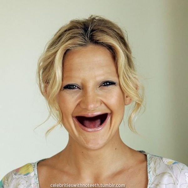 1. Вот перед вами Кейт Хадсон с широко открытым беззубым ртом