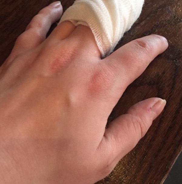 10. Когда порезал(-а) себе палец...