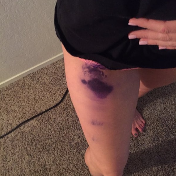 17. Или когда вы держите ручки не в рубашке, а в кармане брюк и вечером видите такую картину