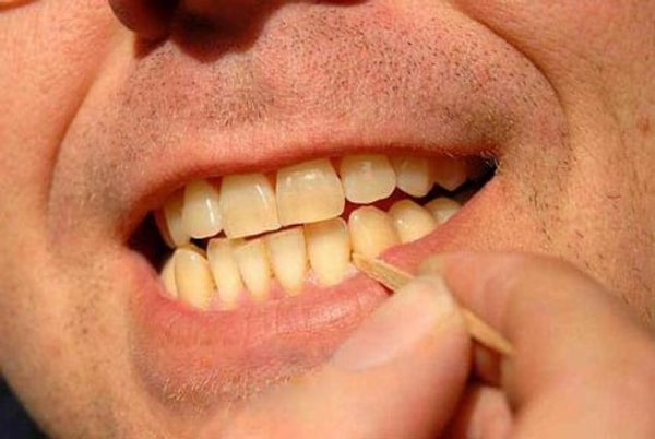 6. С 1900 года примерно 17,000 человек погибло, подавившись зубочисткой