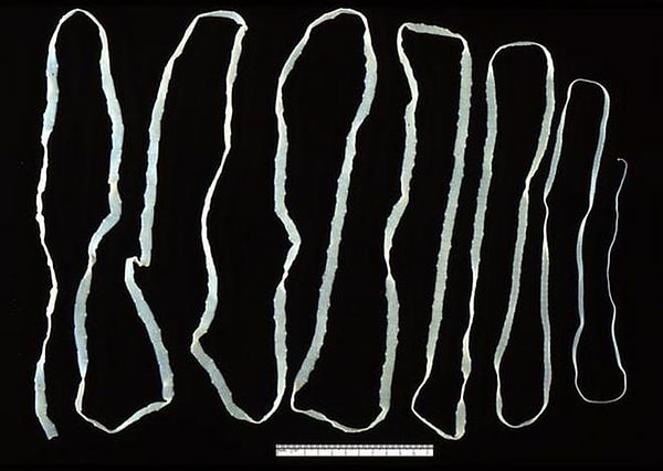 9. Ленточный червь в человеческом организме способен вырастать до 22 метров в длинну