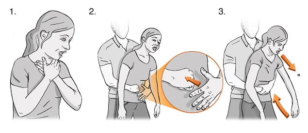 9. Heimlich Manevrası'nı uygulamayı öğrenin.