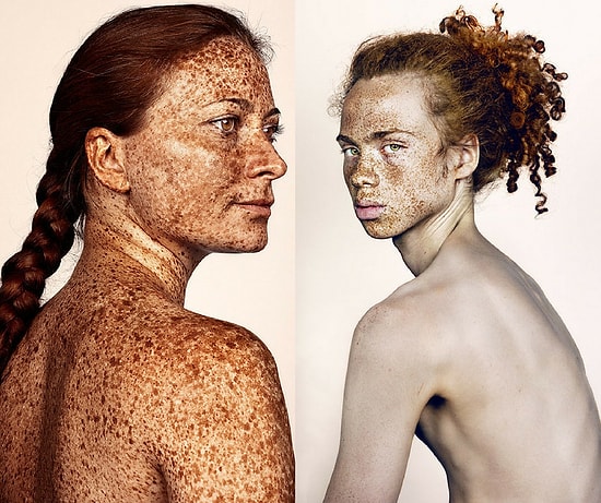 Фотографии, которые прославляют людей с веснушками