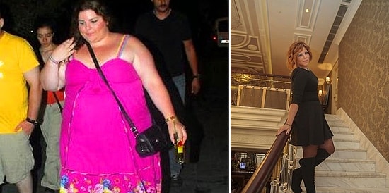 Yeni Bir Hayat İçin Zayıfladılar: Mide Ameliyatı veya Sporla Kilolarından Kurtulan Ünlüler