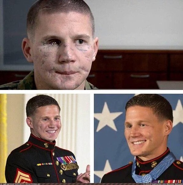 11. Парень прыгнул на гранату, чтобы спасти своих товарищей