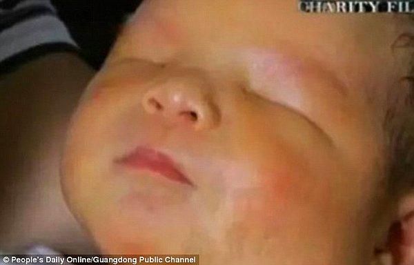Xiao Ming lakaplı olan erkek bebek, bir hafta önce doğduğunda, doktorlar gözü olmadığını fark edemedi.